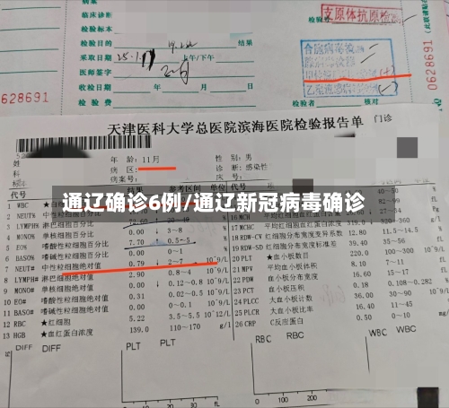 通辽确诊6例/通辽新冠病毒确诊